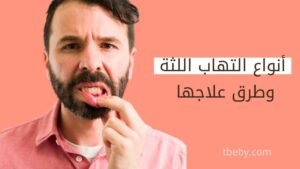 انواع التهاب اللثة