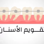 أفضل دكتور تقويم الاسنان