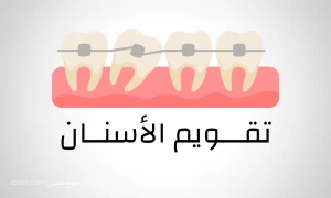 أفضل دكتور تقويم الاسنان