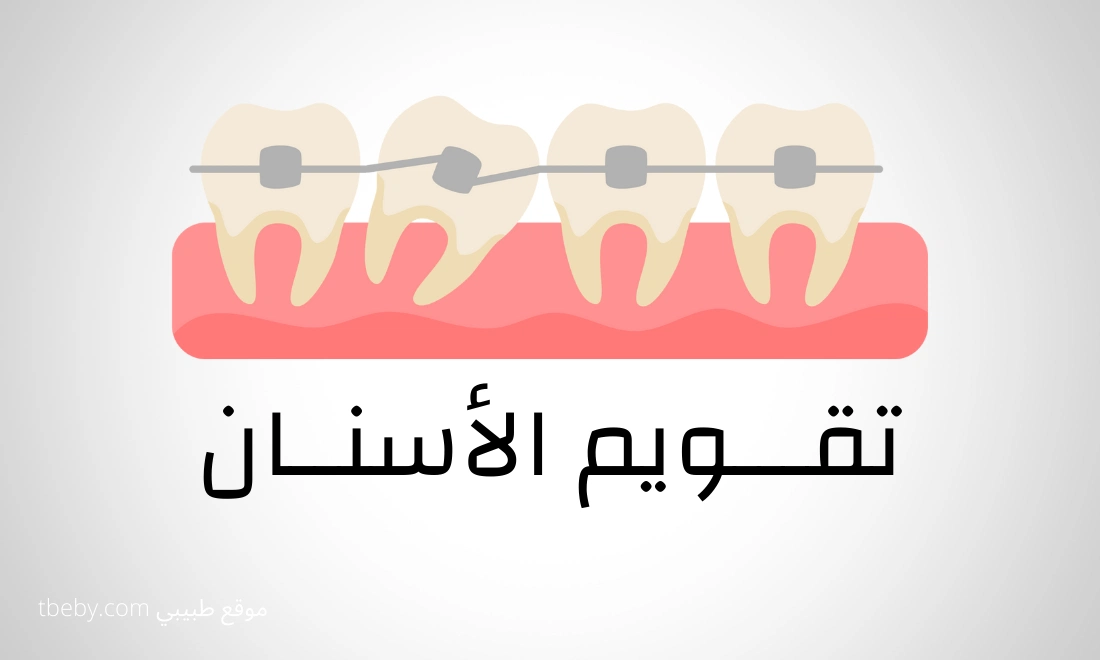 أفضل دكتور تقويم الاسنان