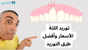 توريد اللثة | الأسعار وأفضل طرق التوريد