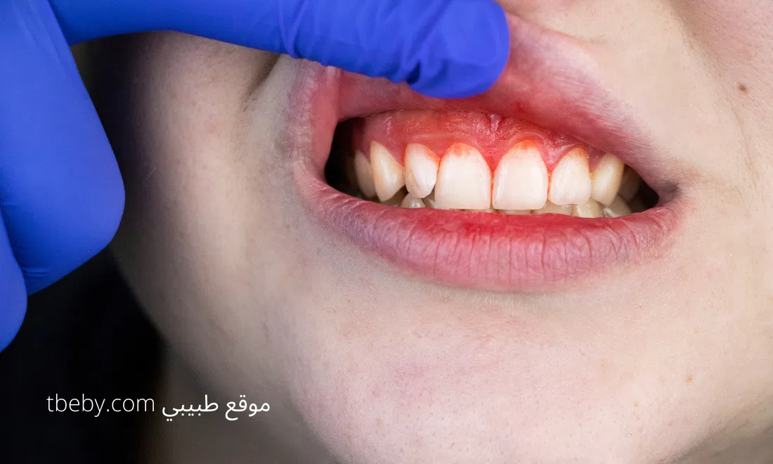 أمراض الفم والأسنان