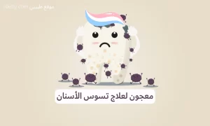 أفضل معجون أسنان لإزالةو وعلاج تسوس الأسنان