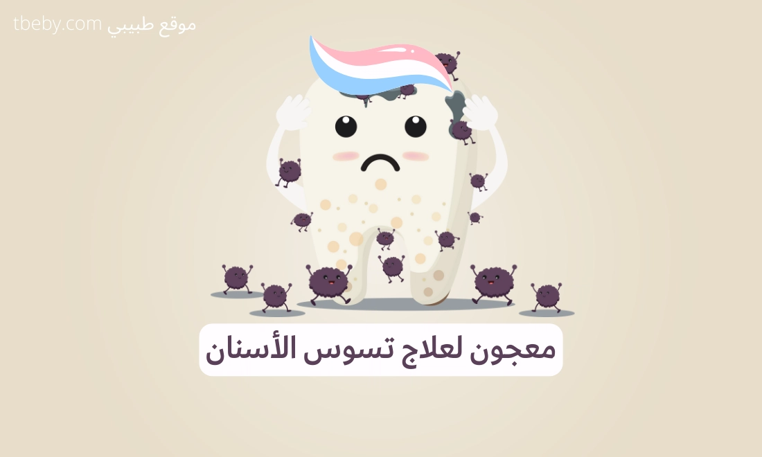 أفضل معجون أسنان لإزالةو وعلاج تسوس الأسنان