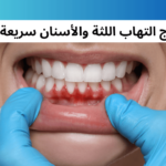 أفضل أدوية علاج التهاب اللثة والأسنان سريعة المفعول