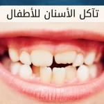 علاج تآكل الأسنان عند الأطفال