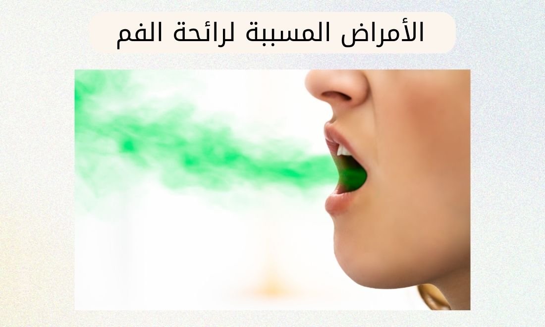 الأمراض التي تسبب رائحة الفم الكريهة
