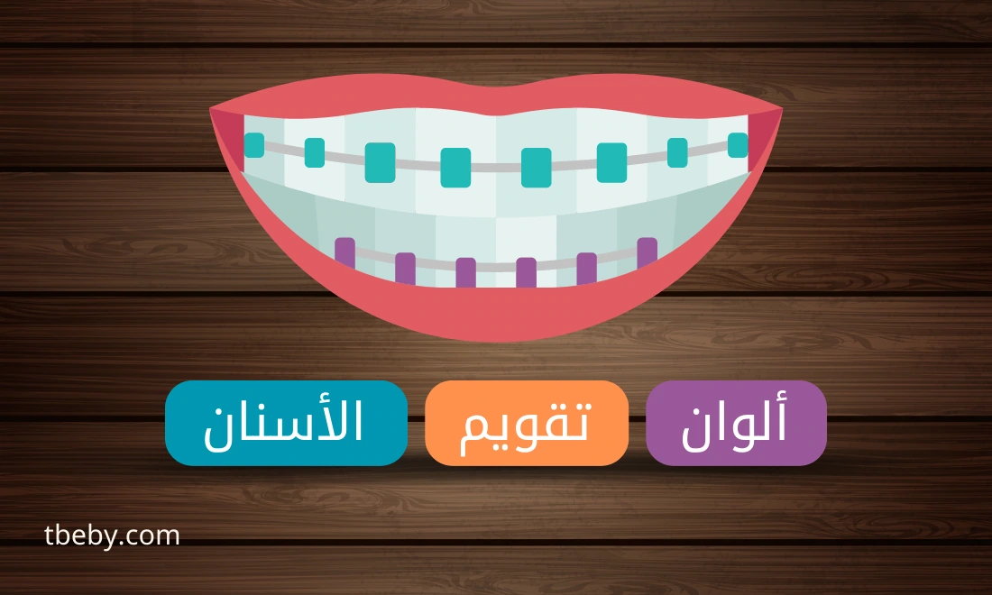 الوان تقويم الأسنان