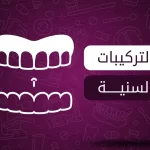 تخصص التركيبات السنية
