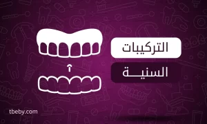 تخصص التركيبات السنية