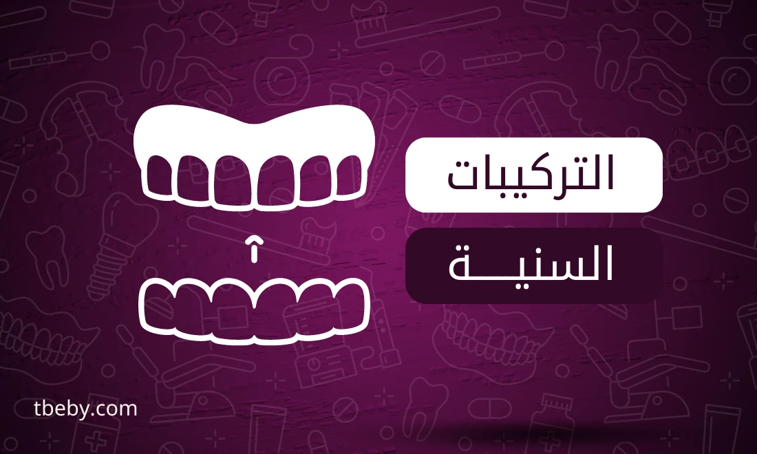 تخصص التركيبات السنية