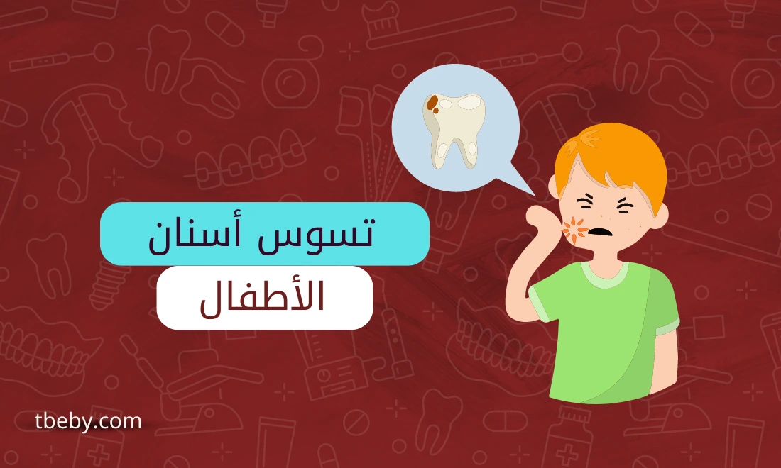 تسوس الاسنان للاطفال