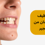 تنظيف الاسنان من الجير