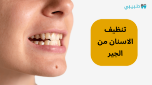تنظيف الاسنان من الجير