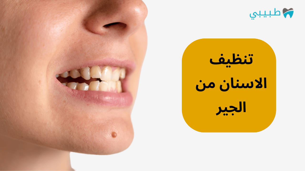 تنظيف الاسنان من الجير