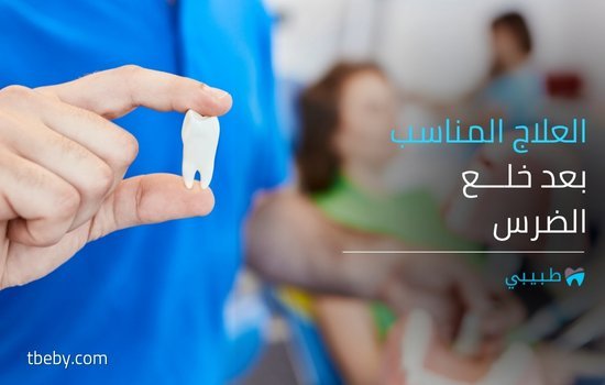 أفضل علاج بعد خلع الضرس