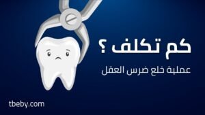 تكلفة خلع ضرس العقل