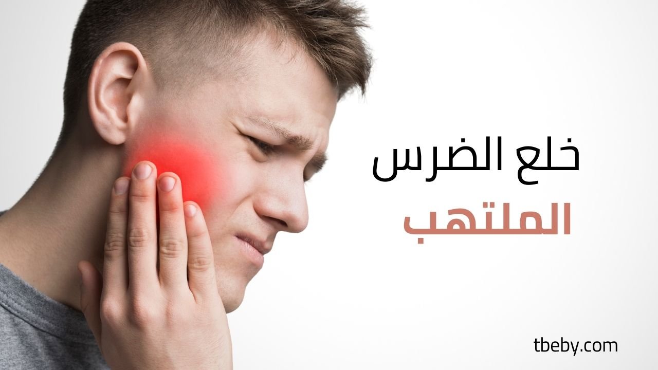 خلع الضرس الملتهب