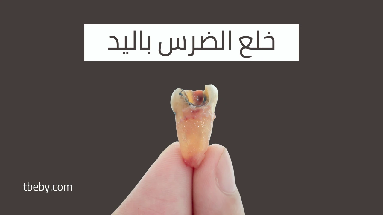 خلع الضرس باليد