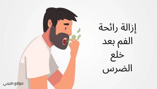 إزالة رائحة الفم بعد خلع الضرس