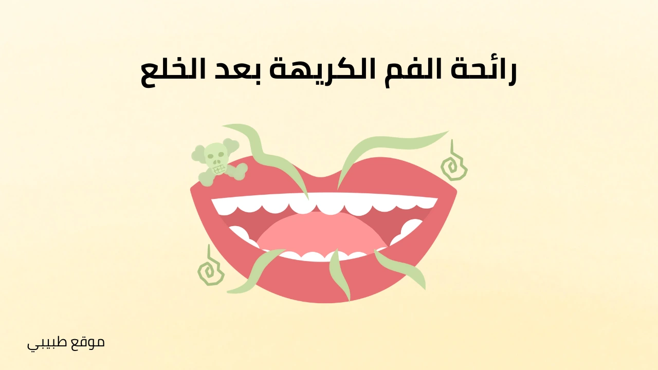علاج رائحة الفم بعد خلع الضرس