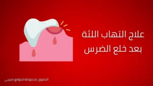علاج التهاب اللثة بعد خلع الضرس