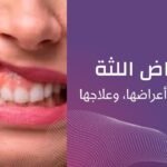 أمراض-اللثة-أسباب-أعراض-علاج