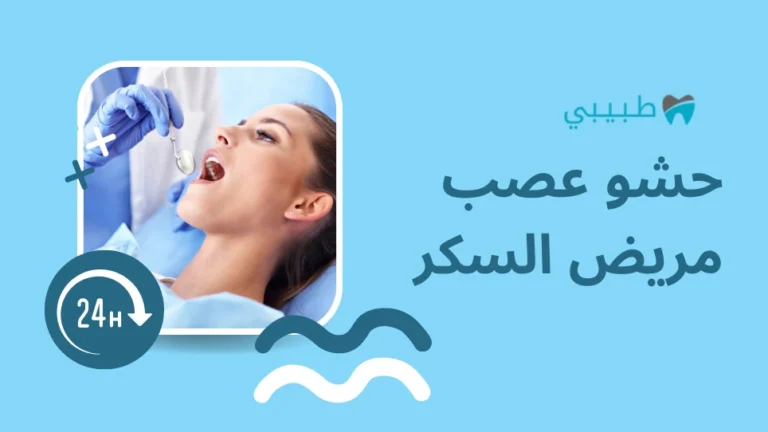 حشو العصب