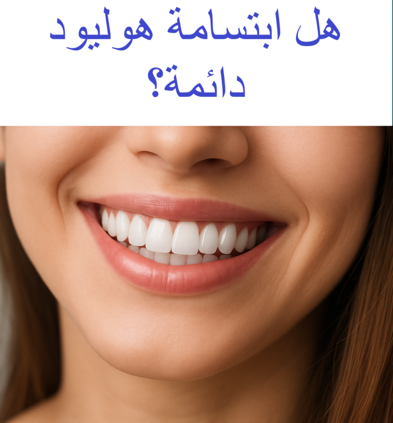 هل ابتسامة هوليود دائمة؟