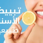 تبييض الأسنان طبيعيا