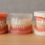 أنواع تقويم الأسنان بالصور واسعارها
