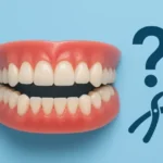 خلع الأسنان الأمامية
