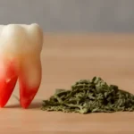 اعشاب لوقف نزيف بعد خلع الضرس