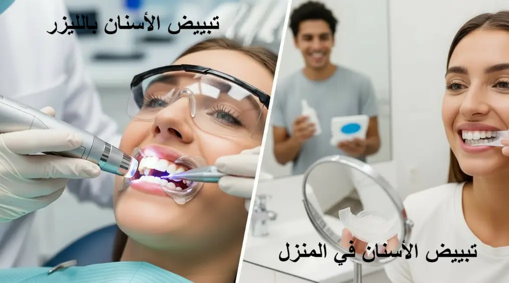 مقارنة بين التبييض بالليزر والتبييض المنزلي
