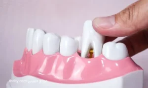 Can a Pregnant Woman Have a Tooth Extracted?