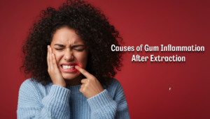 Causes of Gum Inflammation After Extraction