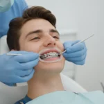 Dental Braces Installation