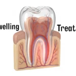 Tooth Swelling Treatment