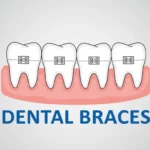 Best Orthodontist & Dental Braces Clinic in Jeddah