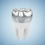 Dental Crown Prices 2026: Best Types, Costs & Complete Guide