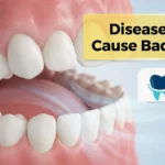 Diseases That Cause Bad Breath: Key Causes and How to Treat Them 2026