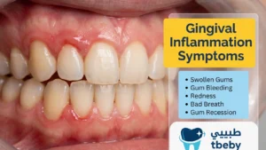 Gingival Inflammation: 6 Common Symptoms, Causes, and Treatment Methods