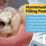 Homemade Tooth Filling Paste 2026: A Complete Guide to Temporary and Permanent Dental Solutions