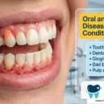 Oral and Dental Diseases: Treatment and Prevention The 5 Most Important Conditions
