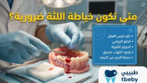متى تكون خياطة اللثة ضرورية؟