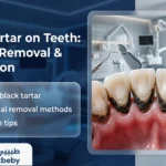 Black Tartar on Teeth – Risks, Causes & Prevention Guide 2026
