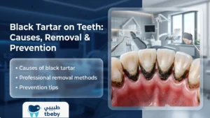 Black Tartar on Teeth – Risks, Causes & Prevention Guide 2026