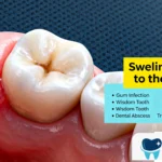 Causes of Swelling Next to the Molar and the Best Treatment Methods