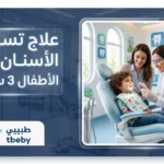 علاج تسوس الأسنان عند الأطفال 3 سنوات: دليل شامل