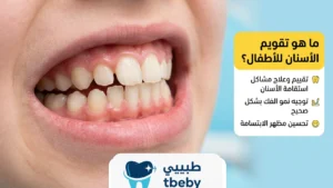ما هو تقويم الأسنان للأطفال؟